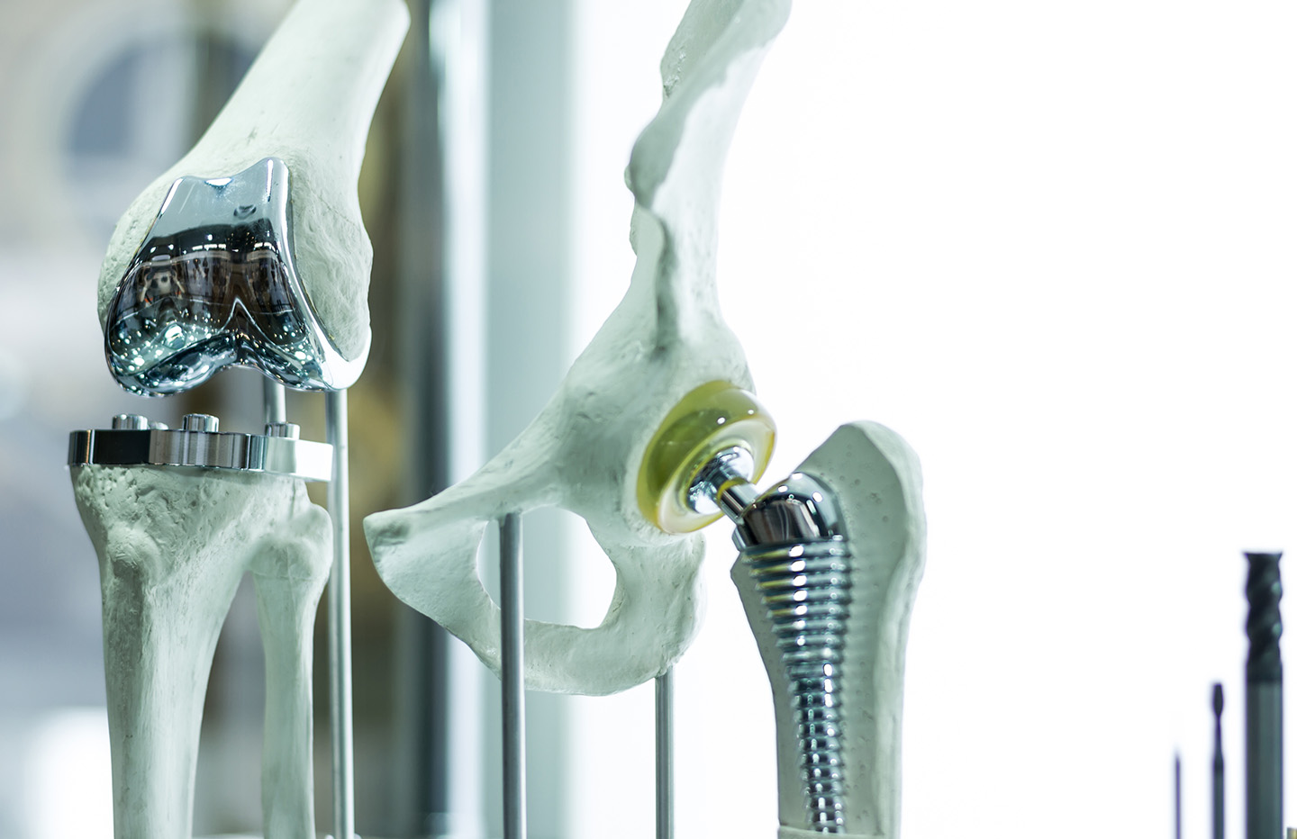 MetalonMetal Hip Implant Injury Lawyers Ponce Law